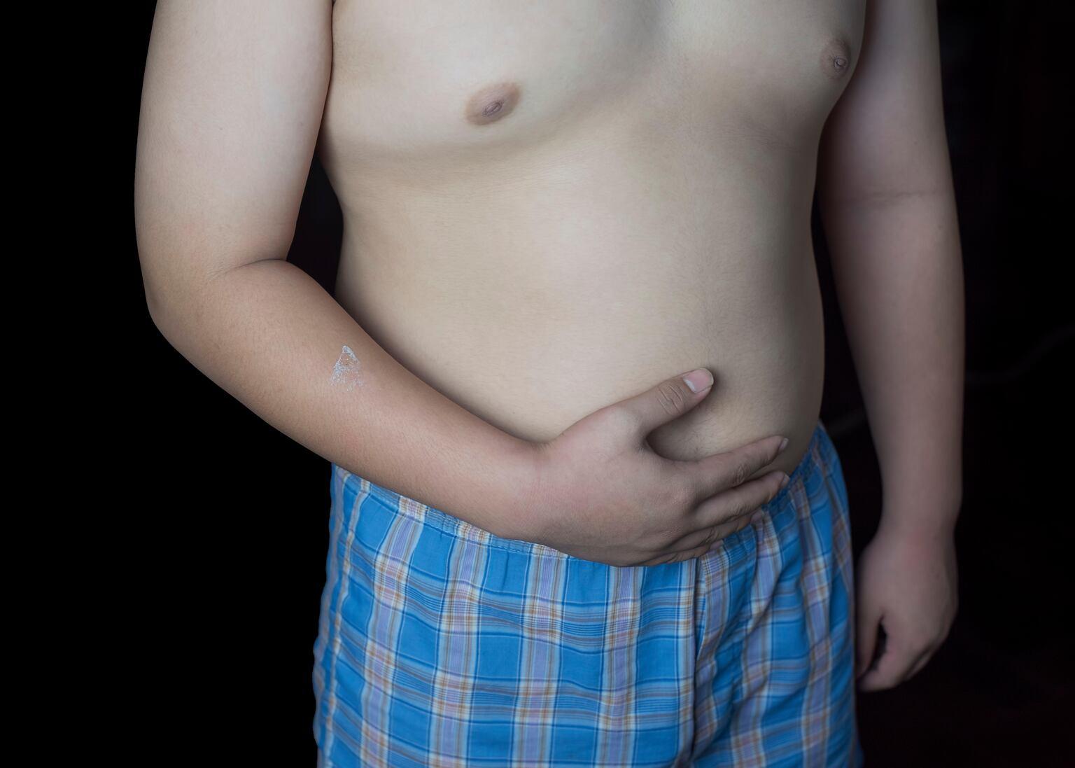 England child obesity rises to record in Reception